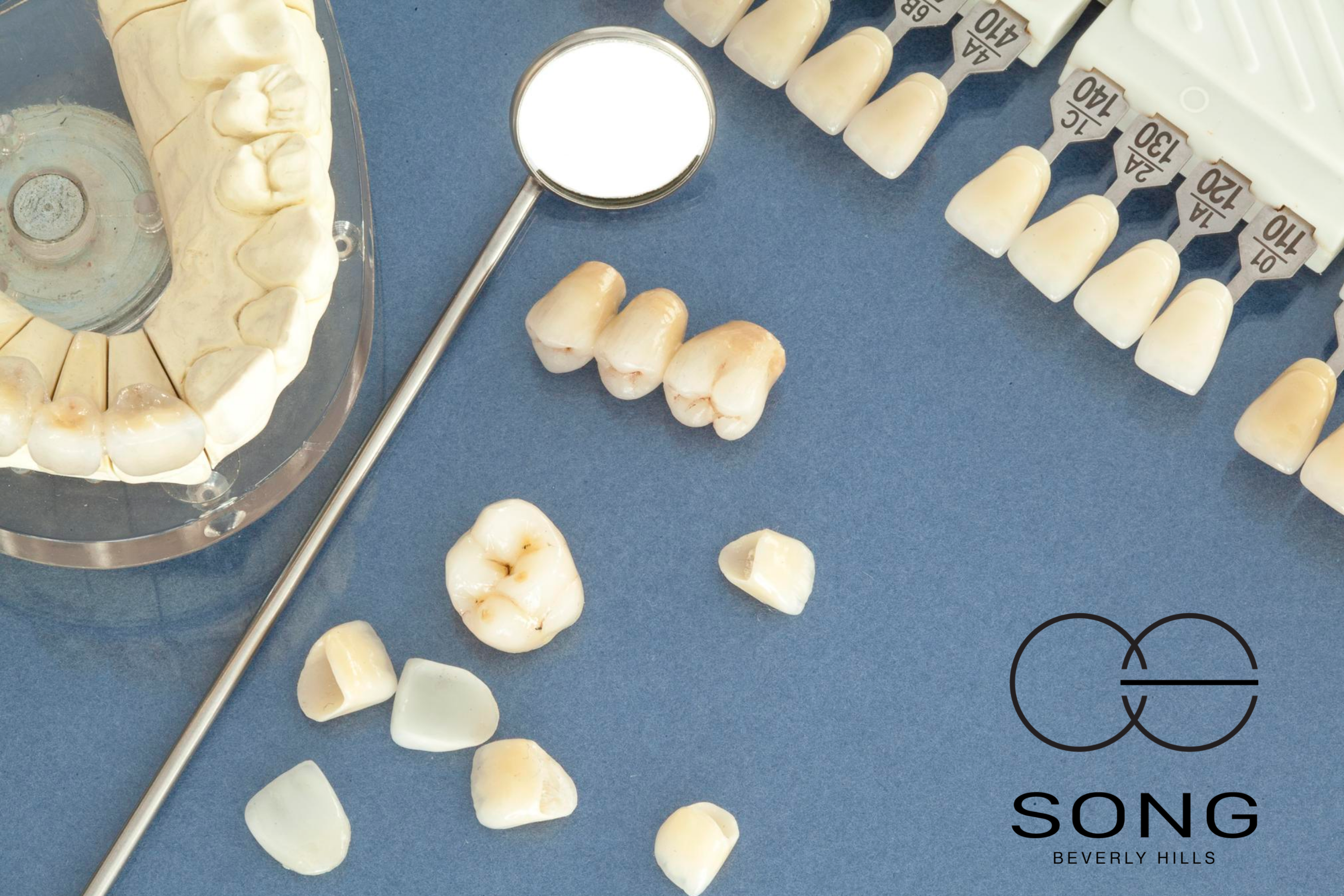 An image of affordable veneers
