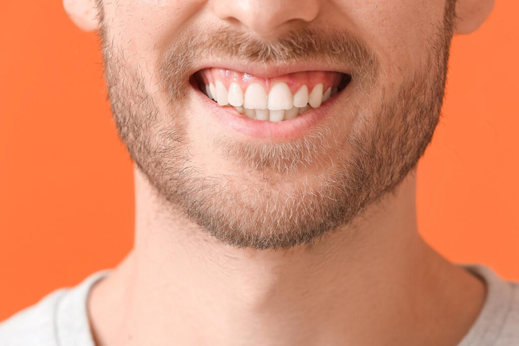 Teeth and the gums and tissues that surround it